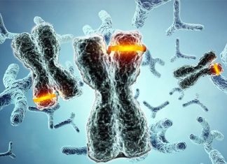 The overexpression of RCAN1 gene cause Down syndrome