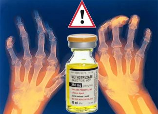 Rheumatoid arthritis drug : methotrexate may elevate a risk of a variety of adverse events