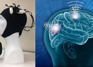 Wearable magnetic device can stimulate the brain to improve recovery for stroke survivors