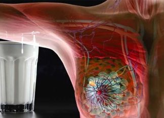 Intake of dairy milk is associated with a greater risk of breast cancer in women
