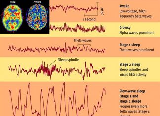 A new deep learning algorithm can distinguish different sleep stages