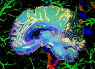Systemic inflammation : microglia can increase the permeability of the blood-brain barrier