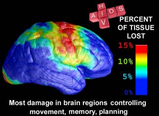 Study reveals how HIV infection and some antiretrovirals affect cognition and the central nervous system