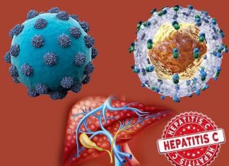 Hepatitis C : New all-direct-acting antiviral regimens without interferon are more than 95 percent effective in eliminating the virus