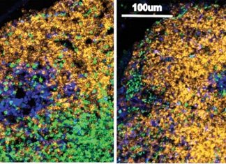 Immune system can be given a helping hand by genital wart treatment
