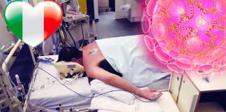 Una nuova ricerca afferma che la posa a faccia in giù è migliore per i polmoni dei pazienti con COVID-19 grave