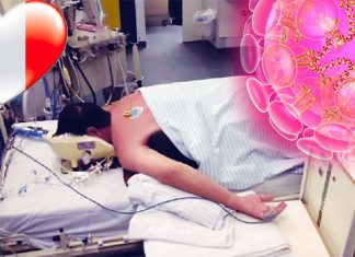 Una nuova ricerca afferma che la posa a faccia in giù è migliore per i polmoni dei pazienti con COVID-19 grave