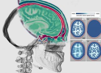 Seismic imaging has the potential to revolutionise brain imaging