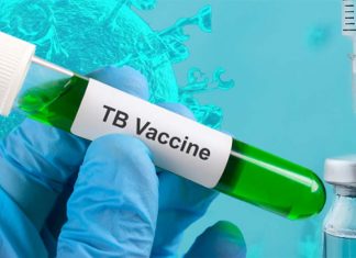 VPM1002 – tuberculosis BCG vaccine may be effective in protecting against COVID-19