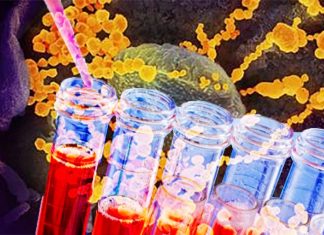 Researchers say the antibodies from the plasma of those who have recovered from COVID-19 may bind to and neutralize SARS-CoV-2