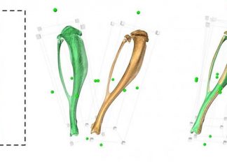 Bones grow curved in response to pressure and strain and these changes can be long-lasting