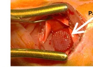In vivo priming technology enhance cardiac repair effectiveness with in vivo priming strategy to train stem cells