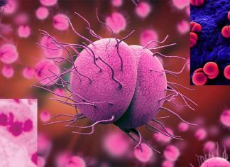 Researchers discovered non-antibiotic therapies for the effective treatment of Neisseria gonorrhoeae infections