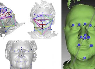 Facial features analyzed from 3D photographs could predict the likelihood of having obstructive sleep apnea