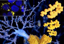Unveiling the Mystery of Amyloid Nuclei: Insights into Polyglutamine Diseases