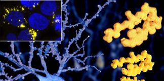Unveiling the Mystery of Amyloid Nuclei: Insights into Polyglutamine Diseases