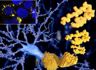 Unveiling the Mystery of Amyloid Nuclei: Insights into Polyglutamine Diseases