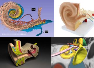 Inner ear : synchrotron X-rays allow to depict details inside the ear three-dimensionally