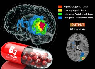 Niacin -vitamin B3 – combined with chemotherapy can help immune cells attack glioblastoma