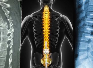 Spinal cord injury increase risk of developing a mental health disorder