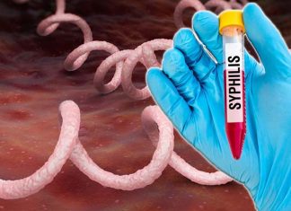 Syphilis – Treponema pallidum, likely uses a single gene to escape the immune system