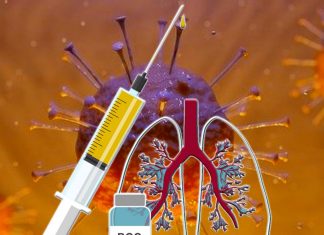 I paesi che hanno una politica di vaccinazione contro la tubercolosi (BCG) hanno una crescita significativamente più lenta dei casi e dei decessi di COVID-19