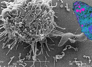 Toxoplasma parasitic infections promote seizures and psychiatric illness