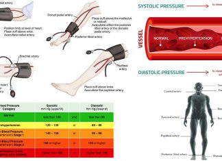 Researchers highlighted the great variability of blood pressure readings between anatomical sites