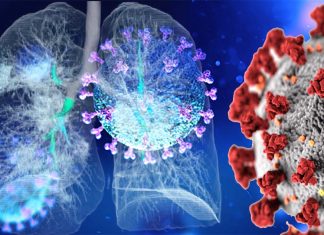 Researchers identified the most common characteristics of patients with fatal COVID-19