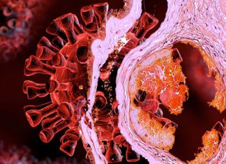 Higher levels of plasmin enhances the virulence and infectivity of SARS-CoV-2 by cleaving its spike protein