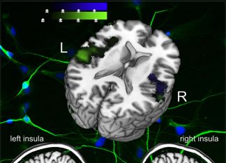 Suicide survivors have a lower sensitivity to body signals due to low brain activity in the insular cortex