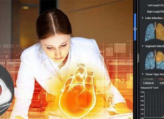 Axial AI is a CT scan diagnosis platform which analyse the progression of COVID-19 with an accuracy rate of more than 90%