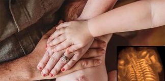 Fetal surgery to correct congenital spinal cord defects is more effective at healing neurological structure than surgery after birth