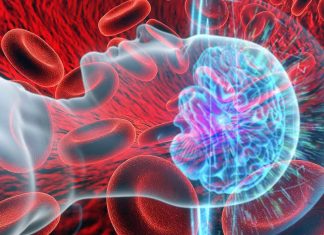 New benefits of using ultrasound treatment to deliver disease-targeting drugs to Alzheimer’s patients
