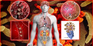 COVID-19 : Analysis of more than 90 autopsies reveals many new details about this disease