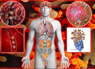COVID-19 : Analysis of more than 90 autopsies reveals many new details about this disease