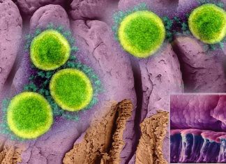 COVID-19 can infect intestinal cells and multiply in the gastrointestinal system