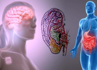 Functional dyspepsia : taVNS can significant improvements in stomach’s ability to accommodate and process a meal