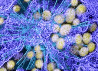 First clear evidence of a link between SARS-CoV-2 infection and Kawasaki disease