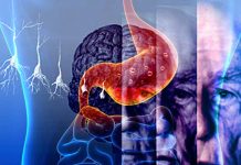 Understanding the Complex Relationship Between Long-Term PPI Use and Dementia