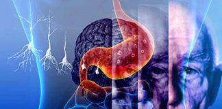 Understanding the Complex Relationship Between Long-Term PPI Use and Dementia