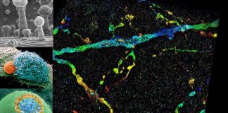 New microscopy imaging technology allows visualization of nanoscale structures inside whole cells