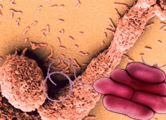 Stenotrophomonas maltophilia strains is now considered to be one of the most feared hospital pathogens