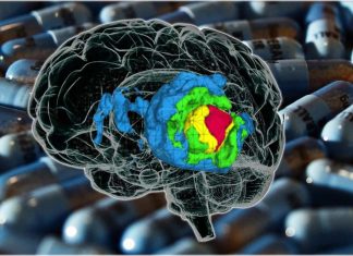Trifluoperazine used in combination with radiation therapy delays the growth of glioblastoma brain tumors and prolongs survival for brain cancer