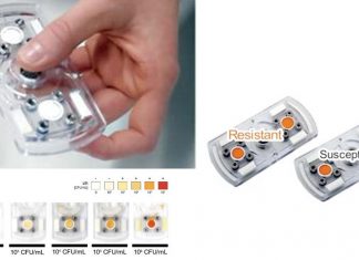 Researchers has developed a fidget-spinner-like device that is able to detect UTIs in urine samples