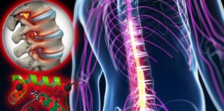 Scientists have discovered a new treatment to dramatically reduce swelling after brain and spinal cord injuries