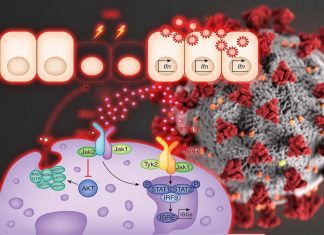 COVID-19 : interferon lambda (λ) can fight viral infection while limiting inflammatory damage