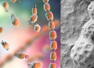 Coccidioides fungi : Immune modulation can treat the severe and often fatal fungal infection