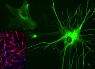 Malfunction of astrocytes in the cingulate cortex triggers migraine