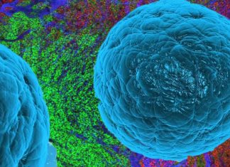 Manipulating macrophages could be a viable strategy for treating cancer